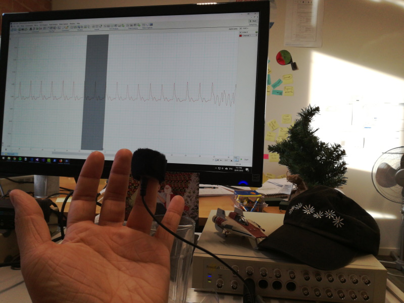 Recording the pulse on a powerlab